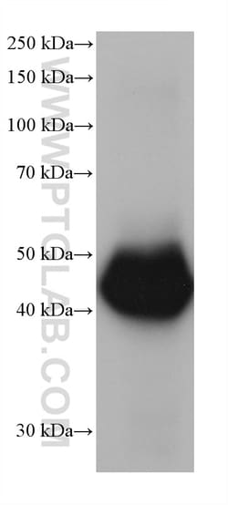 ALDH2 Mouse Monoclonal Antibody, Proteintech Unconjugated; 20 &mu;L:Antibodies,