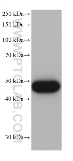 ALDH2 Mouse Monoclonal Antibody, Proteintech Unconjugated; 20 &mu;L:Antibodies,