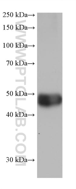 ALDH2 Mouse Monoclonal Antibody, Proteintech Unconjugated; 20 &mu;L:Antibodies,