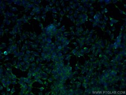 ALDH3A1 Mouse Monoclonal Antibody, Proteintech Unconjugated; 20 &mu;L:Antibodies,