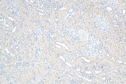 ALDH3A1 Mouse Monoclonal Antibody, Proteintech Unconjugated; 20 &mu;L:Antibodies,