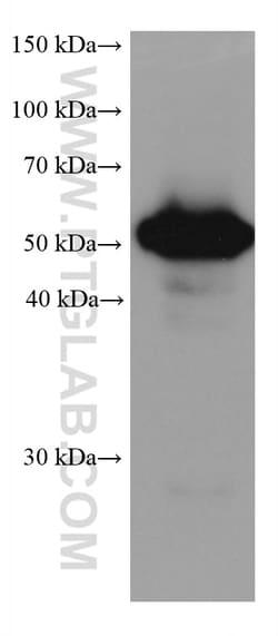 ALDH3A1 Mouse Monoclonal Antibody, Proteintech Unconjugated; 20 &mu;L:Antibodies,