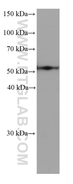ALDH3A1 Mouse Monoclonal Antibody, Proteintech Unconjugated; 20 &mu;L:Antibodies,