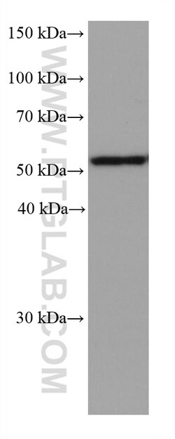 ALDH3A1 Mouse Monoclonal Antibody, Proteintech Unconjugated; 20 &mu;L:Antibodies,