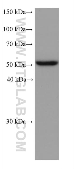 ALDH3A1 Mouse Monoclonal Antibody, Proteintech Unconjugated; 20 &mu;L:Antibodies,