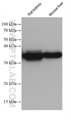 ALDOB Mouse Monoclonal Antibody, Proteintech Unconjugated; 20 &mu;L:Antibodies,