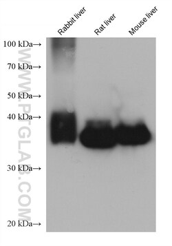 ALDOB Mouse Monoclonal Antibody, Proteintech Unconjugated; 20 &mu;L:Antibodies,