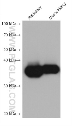 ALDOB Mouse Monoclonal Antibody, Proteintech Unconjugated; 20 &mu;L:Antibodies,