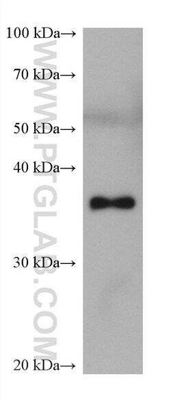 ALDOB Mouse Monoclonal Antibody, Proteintech Unconjugated; 20 &mu;L:Antibodies,