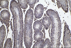 ALKBH5 Mouse Monoclonal Antibody, Proteintech:Antibodies:Primary Antibodies
