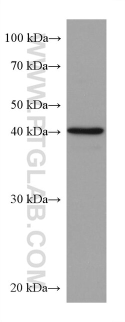ALKBH5 Mouse Monoclonal Antibody, Proteintech:Antibodies:Primary Antibodies