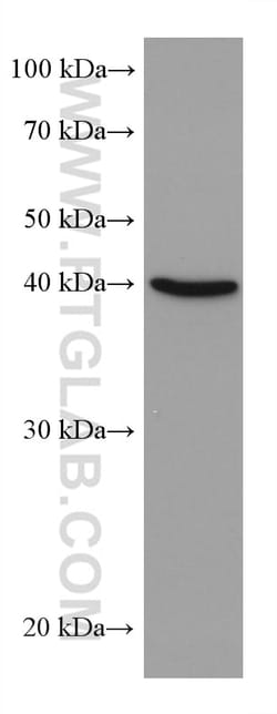 ALKBH5 Mouse Monoclonal Antibody, Proteintech:Antibodies:Primary Antibodies