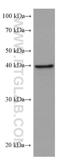 ALKBH5 Mouse Monoclonal Antibody, Proteintech:Antibodies:Primary Antibodies