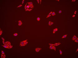AMT Mouse Monoclonal Antibody, Proteintech Unconjugated; 20 &mu;L:Antibodies,