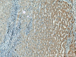 AMT Mouse Monoclonal Antibody, Proteintech Unconjugated; 20 &mu;L:Antibodies,