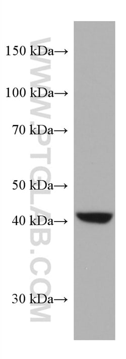AMT Mouse Monoclonal Antibody, Proteintech Unconjugated; 20 &mu;L:Antibodies,