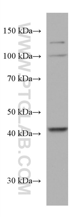 AMT Mouse Monoclonal Antibody, Proteintech Unconjugated; 20 &mu;L:Antibodies,