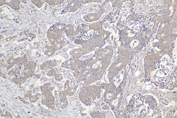 ANK1 Rabbit Polyclonal Antibody, Proteintech Unconjugated; 150 &mu;L:Antibodies,