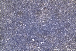 ANK1 Rabbit Polyclonal Antibody, Proteintech Unconjugated; 150 &mu;L:Antibodies,