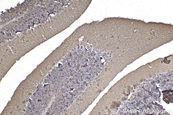 ANK1 Rabbit Polyclonal Antibody, Proteintech Unconjugated; 150 &mu;L:Antibodies,