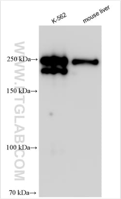 ANK1 Rabbit Polyclonal Antibody, Proteintech Unconjugated; 150 &mu;L:Antibodies,