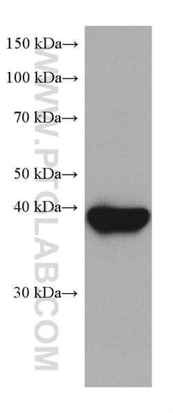 ANKRD1 Mouse Monoclonal Antibody, Proteintech:Antibodies:Primary Antibodies