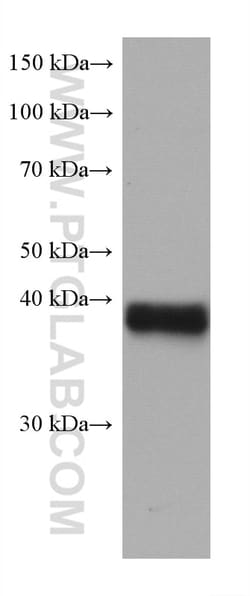 ANKRD1 Mouse Monoclonal Antibody, Proteintech:Antibodies:Primary Antibodies