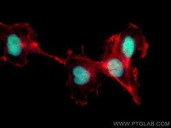 ANP32A Mouse Monoclonal Antibody, Proteintech:Antibodies:Primary Antibodies