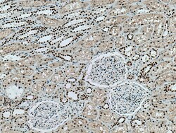 ANP32A Mouse Monoclonal Antibody, Proteintech:Antibodies:Primary Antibodies