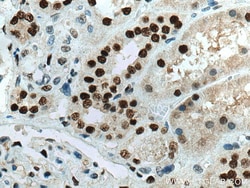 ANP32A Mouse Monoclonal Antibody, Proteintech:Antibodies:Primary Antibodies