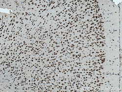 ANP32A Mouse Monoclonal Antibody, Proteintech:Antibodies:Primary Antibodies