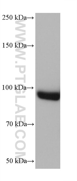 AP2B1 Mouse Monoclonal Antibody, Proteintech Unconjugated; 150 &mu;L:Antibodies,