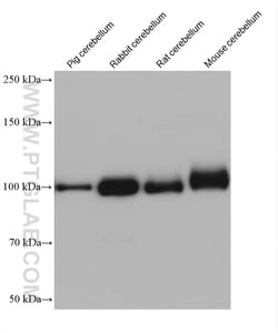 AP2B1 Mouse Monoclonal Antibody, Proteintech Unconjugated; 150 &mu;L:Antibodies,