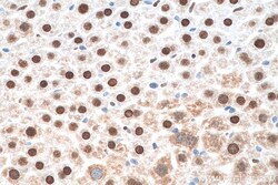 APEX1 Mouse Monoclonal Antibody, Proteintech:Antibodies:Primary Antibodies