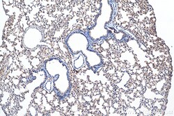 AQP5 Rabbit Polyclonal Antibody, Proteintech:Anticorps:Anticorps primaires