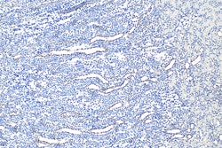 AQP5 Rabbit Polyclonal Antibody, Proteintech:Anticorps:Anticorps primaires
