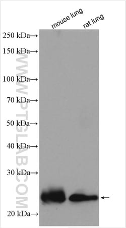 AQP5 Rabbit Polyclonal Antibody, Proteintech