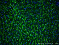 AQP9 Rabbit Polyclonal Antibody, Proteintech Unconjugated; 150 &mu;L:Antibodies,