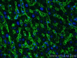 AQP9 Rabbit Polyclonal Antibody, Proteintech Unconjugated; 150 &mu;L:Antibodies,