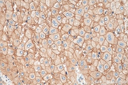 AQP9 Rabbit Polyclonal Antibody, Proteintech Unconjugated; 150 &mu;L:Antibodies,