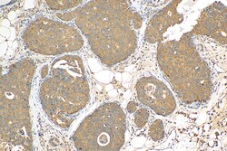 ARHGAP29 Rabbit Polyclonal Antibody, Proteintech:Antibodies:Primary Antibodies