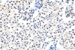 ARID1A Rabbit Polyclonal Antibody, Proteintech Unconjugated; 20 &mu;L:Antibodies,