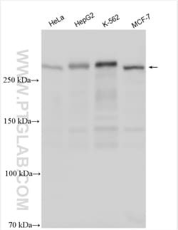 ARID1A Rabbit Polyclonal Antibody, Proteintech Unconjugated; 20 &mu;L:Antibodies,