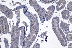 ARID2 Rabbit Polyclonal Antibody, Proteintech Unconjugated; 150 &mu;L:Antibodies,