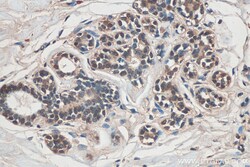 ARID4B Mouse Monoclonal Antibody, Proteintech:Antibodies:Primary Antibodies