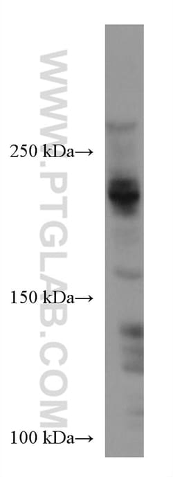 ARID4B Mouse Monoclonal Antibody, Proteintech:Antibodies:Primary Antibodies