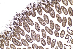 ARIH1 Rabbit Polyclonal Antibody, Proteintech:Antibodies:Primary Antibodies