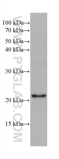 ARL3 Mouse Monoclonal Antibody, Proteintech Unconjugated; 20 &mu;L:Antibodies,