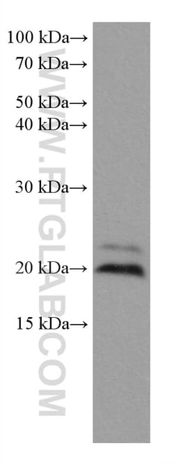 ARL8B Mouse Monoclonal Antibody, Proteintech Unconjugated; 150 &mu;L:Antibodies,