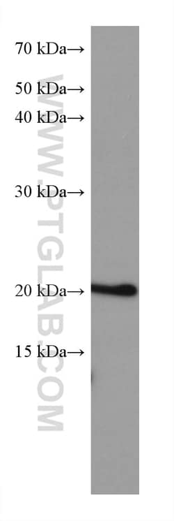 ARL8B Mouse Monoclonal Antibody, Proteintech Unconjugated; 150 &mu;L:Antibodies,